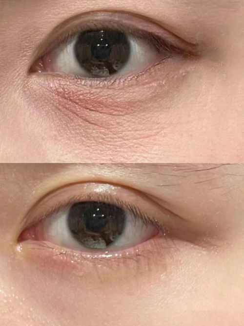 强！最新十大眼霜排行各价位天花板AG旗舰厅入口抗皱眼霜排行榜前十(图5)